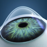 جراحی اصلاحی چشم لیزیک